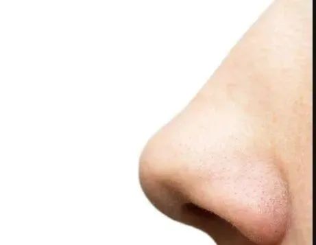 枸杞|肾功能弱的人，身体3处会“变黑”，1处会“变白”