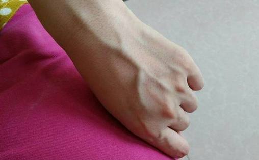 #肝脏#手上出现这3个表现，多半时肝在“求救”，别不当回事！