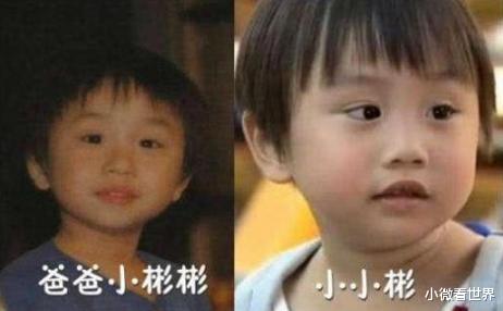 「小小彬」他给亲爸买豪宅, 赚钱给后妈整容, 皮肤溃烂却遭袖手旁观, 今怎样了