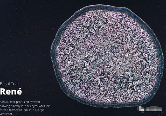 科学家|人类的眼泪是什么样子？科学家将它放大3000倍后，你还敢哭吗？