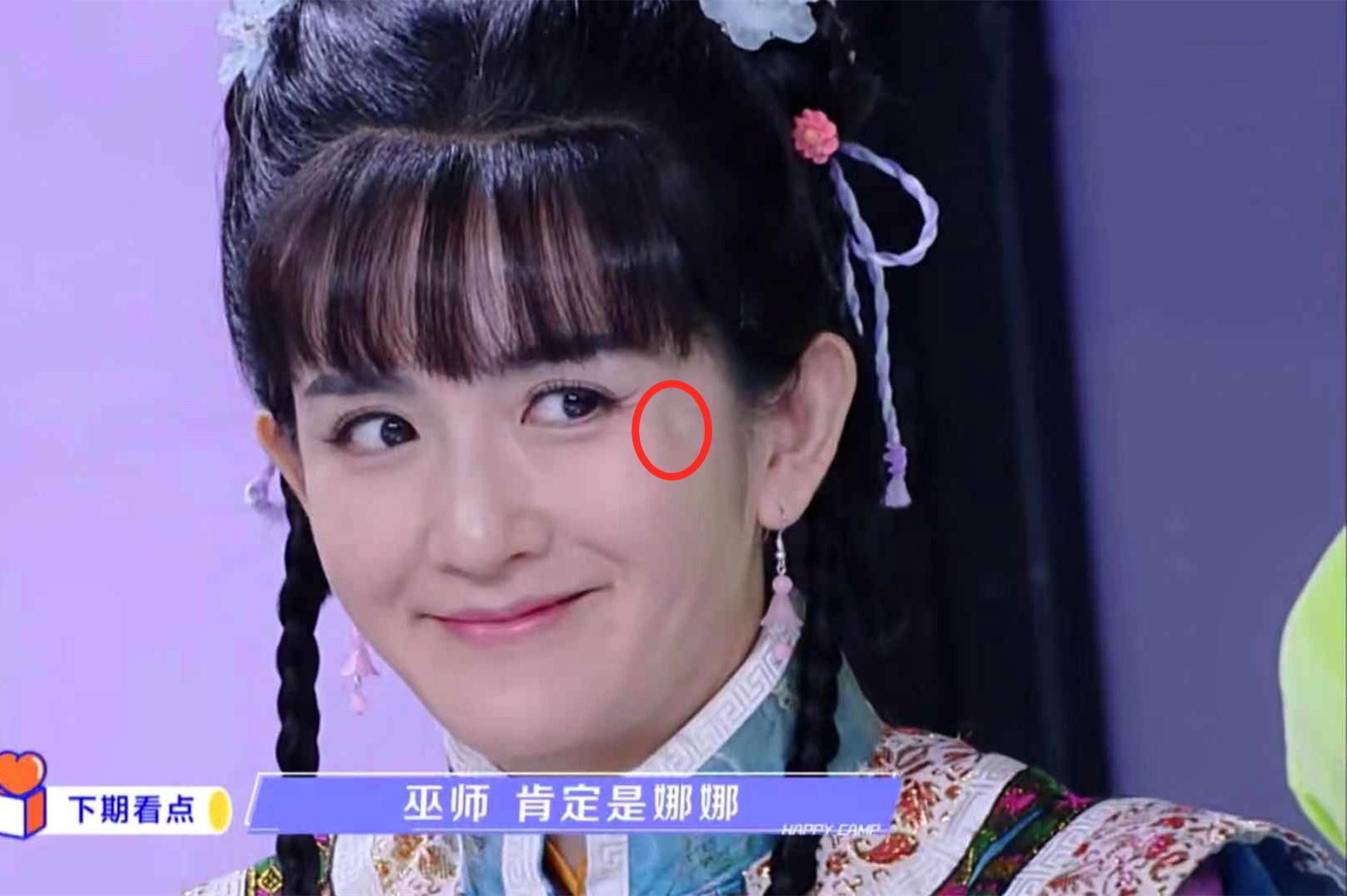 谢娜|谢娜的脸怎么了？笑起来眼角出现奇怪大坑，引网友整容猜疑
