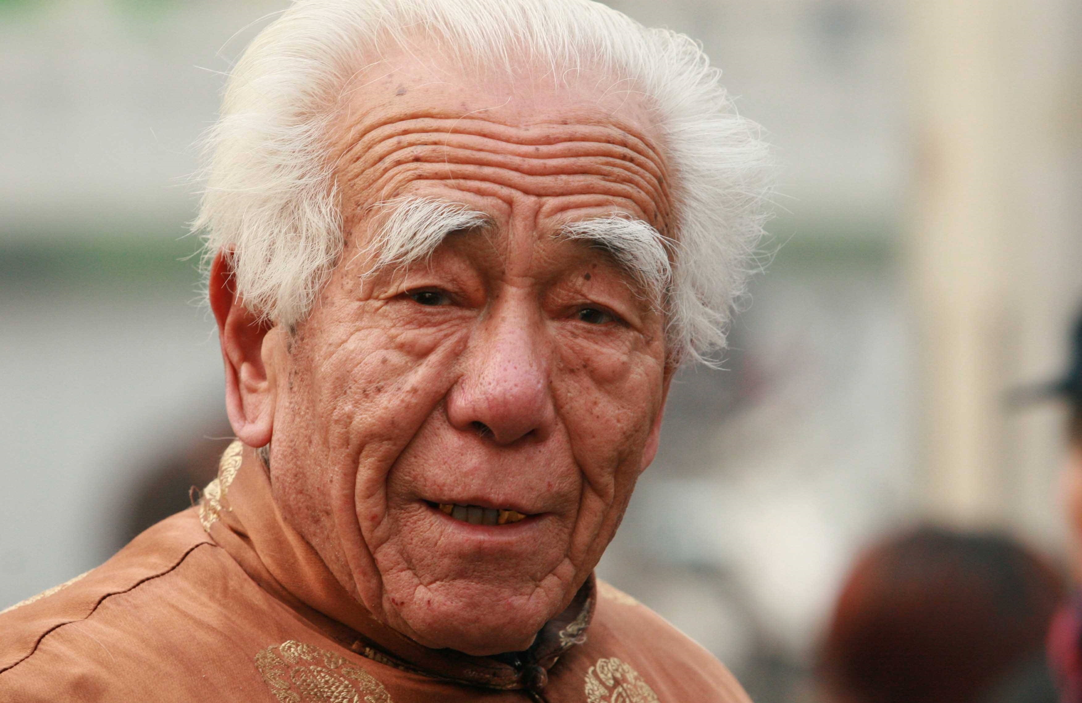 长寿|寿命“短”的人,身上有4处发白,若1个都不占,说明身体很健康