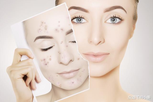 #护肤#皮肤暗黄无光怎么办 这样护肤肌肤更有光彩