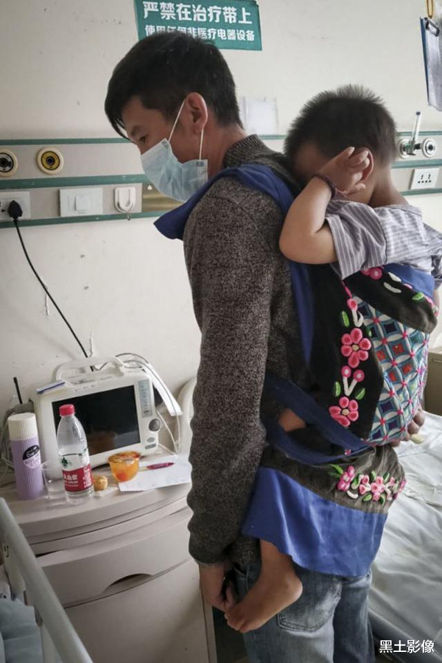 医生|云南一男童眼睛一直往外冒“脏东西”，医生一句话爸爸直接傻眼了