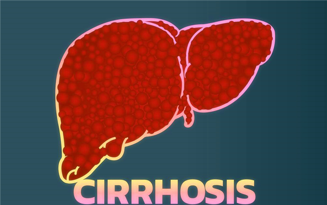 「肝脏」肝硬化的时候，肝脏发生了什么变化？你真的知道吗？看专家的理解