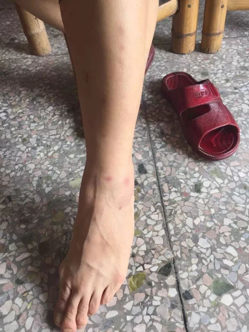 红火蚁@遇到这种小红土堆，千万别碰！广东各地都有