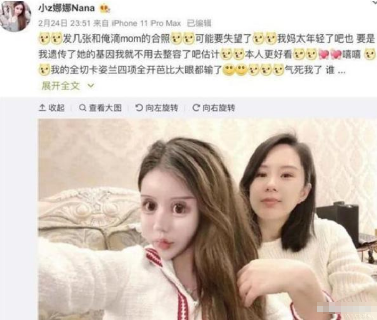整容|那个13岁开始整容，3年整容60多次的网红女孩，如今怎么样了？