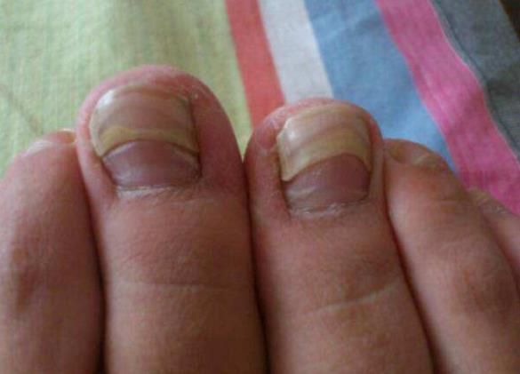 []脚上出现这8个情况，说明体内出现了疾病问题，还请及时就诊！