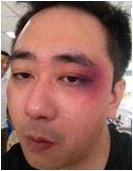 『王自健』被前妻扇500耳光、6次烟头烫8次打住院的王自健，如今又曝新情况