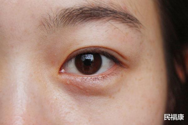 【】一勺猪油十副药？吃猪油，到底有啥好处？真正明白的人没多少