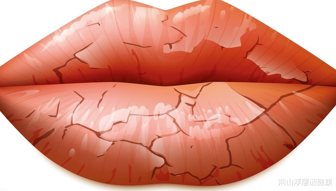 肠癌|肝不好,嘴先知!嘴巴出现这4种“异常”,或是肝病已“到访”