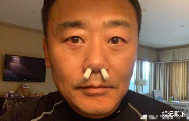 #周立波#定居美国的周立波近照曝光,鼻孔插葱脸色憔悴,发文控诉遇人不淑