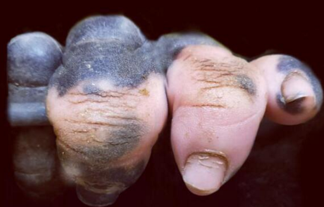 |美国一大猩猩进化出人类手指，引起全球轰动，未来会进化成人类？