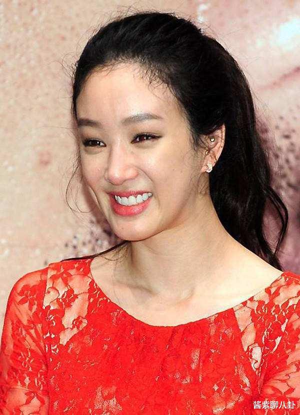 郑丽媛▲整容界奇迹，郑丽媛曾被整毁的脸又整回来了，希望李多海多多学习