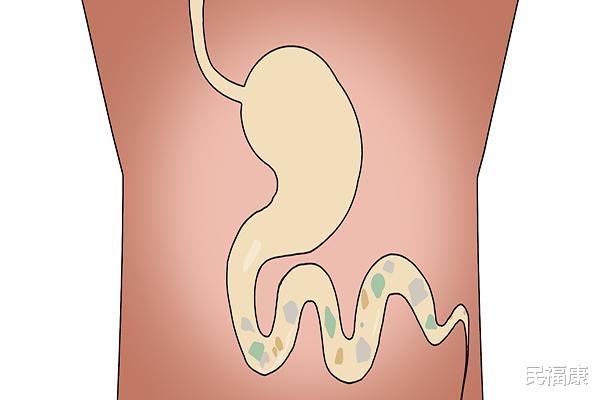 便秘@人身体里有12斤的宿便？已扎根肠道的粪便，怎么才能快速清理掉？