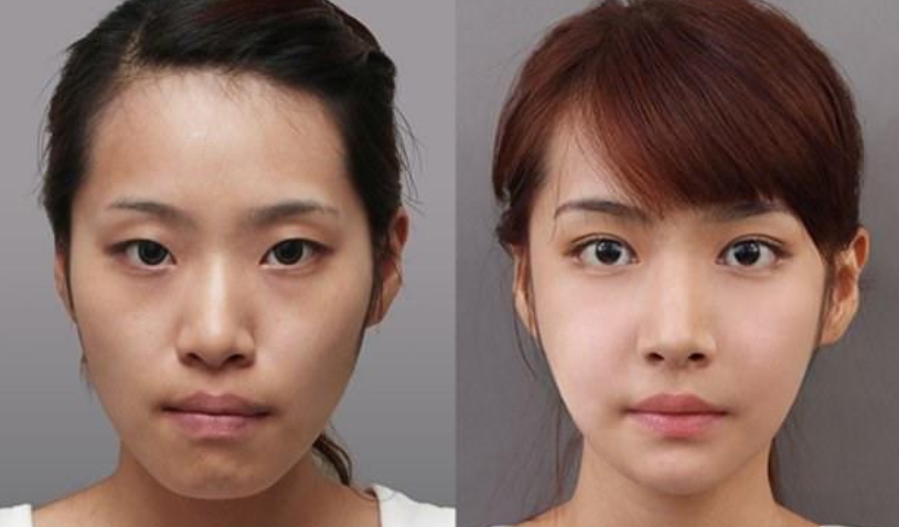 药店一种“很低调”医用眼霜，堪称眼袋、眼纹“天敌”，却因廉价被嫌弃