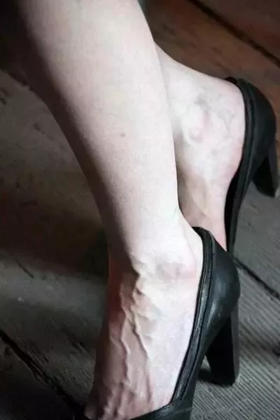 [牛肉]手上青筋越多，说明身体越.....