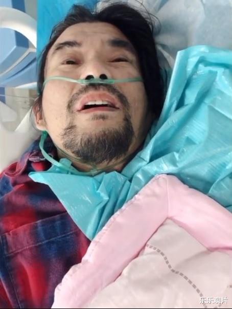 面筋哥|面筋哥患肺癌晚期接受手术，整个人已经瘦到完全脱相