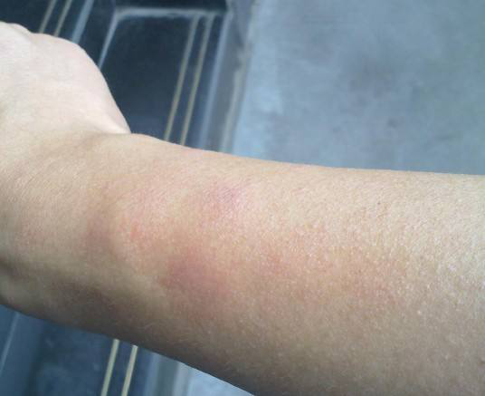 身体这些小毛病，千万不能轻视！它们可能代表甲醛正威胁健康！