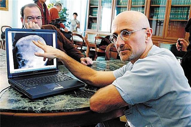 臆说古史|世界首例活人“换头”手术，俄罗斯程序员自愿参加，后来情况如何