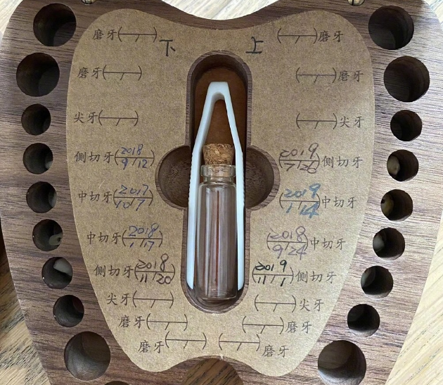 孙俪|孙俪女儿牙掉了,一不小心却带火了存牙器,带娃果然很有一套