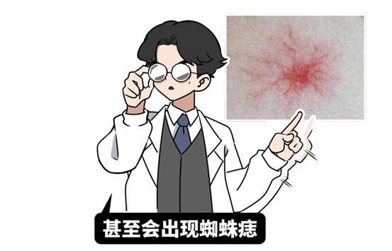 肝脏|小酌怡情,有益健康?世界顶级期刊:每一滴酒,都在损害你的身体