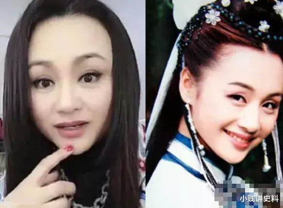 「王心凌」被玻尿酸“毁掉”的女明星！李小璐不自然，王心凌不能笑，而她让人怀疑眼睛