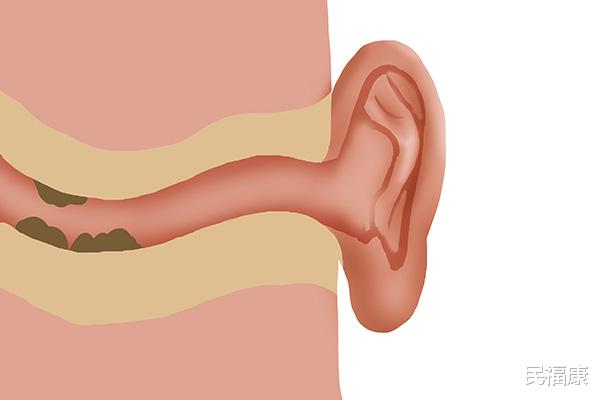 疾病|老是觉得耳朵痒，又掏不出东西，是什么在作怪？真相告诉你