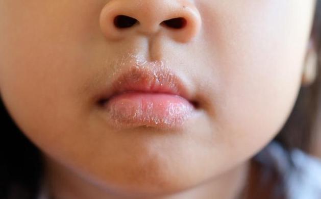 肝脏▲当肝功能异常时，嘴巴常有5个症状，若一个没占，说明你肝脏健康