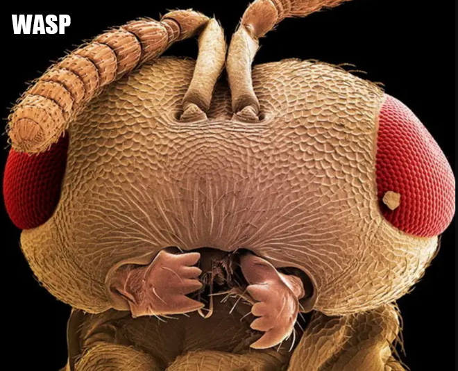 【显微镜】蚂蚁的屁股放在显微镜下是什么样的，知道吗？