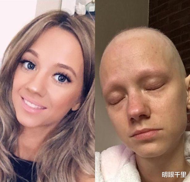宫颈癌|美女出现宫颈癌症状，却被护士告知是正常现象，两年后就去世了