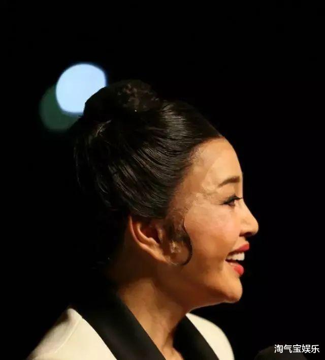 刘晓庆|刘晓庆怎么了！网友害怕：体态狂胖50斤，“硅胶脸”油腻畸形！