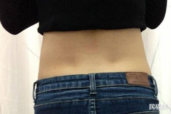 |为何有些女性后腰处会有两个凹点？有什么用吗？