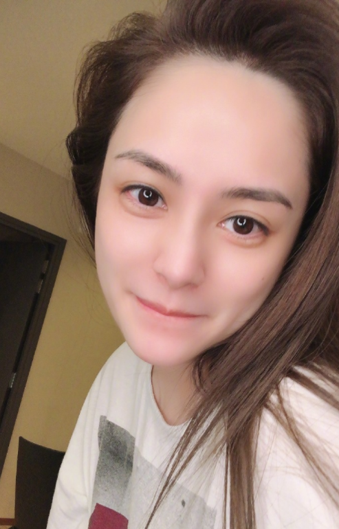 阿娇|阿娇第二次手术重新缝合几百针，任达华介绍顶级整形科医生