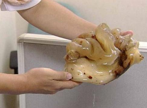 科学家▲地球上的活化石——太岁,生命力惊人,科学家说:已违背自然规律