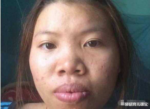 【整容】她曾因相貌太丑而整容，后嫁给富二代，如今3年过去女儿长成这样