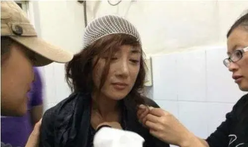 叶璇|她曾是古装第一美人,却被叶璇的狗咬伤毁容,整容5次靠演技翻身