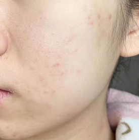 防晒|便宜却实力过硬的护肤品,这几款是我的孕期心头爱!回购到手软!