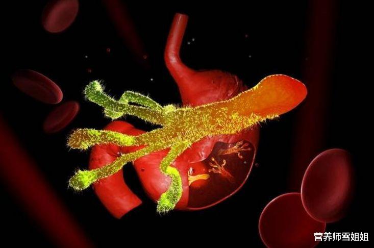 #胃癌#28岁女子，胃癌晚期，提醒：“饭后”3种异常，最好查一下胃镜