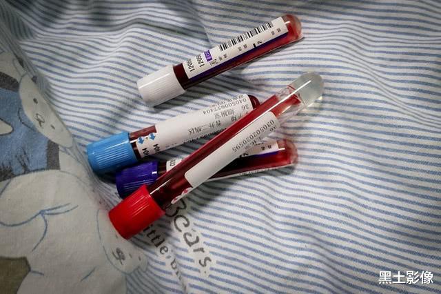 湖北@湖北3岁男童患重症手术后以为迎来新生,没想到18小时后又进了ICU