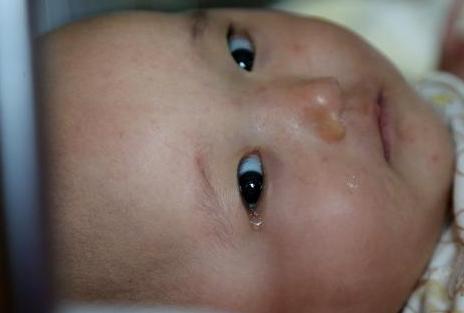 医生|10岁男孩患肠癌，这三类食物进“黑名单”，医生：建议别给孩子吃