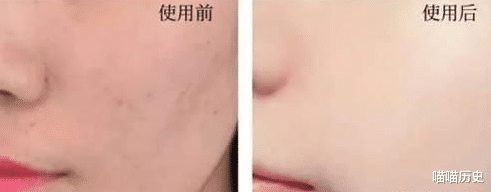 氨基酸|自以为是在护肤，其实很“伤”皮肤的4种习惯，难怪皮肤一直不好