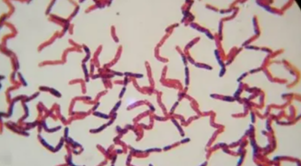 科学家|科学家为求“永生”，给自己注射350万年前的细菌，后来如何？