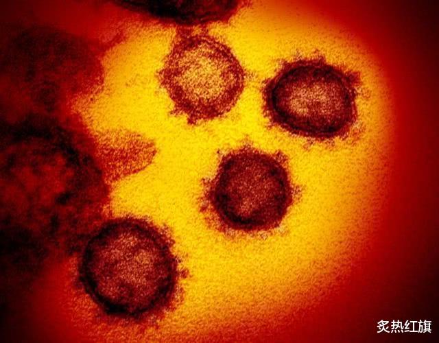 「美国」死亡超7万之际，美国传来一个坏消息，又一种新的病毒已广泛传播