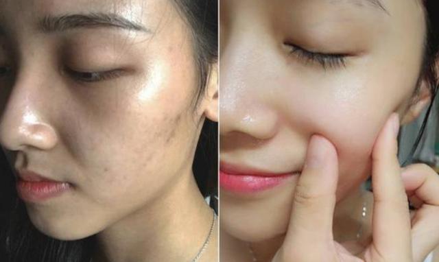 护肤品■继“百雀羚”后,中国又一“平价”护肤品火了!高质低价力压兰蔻