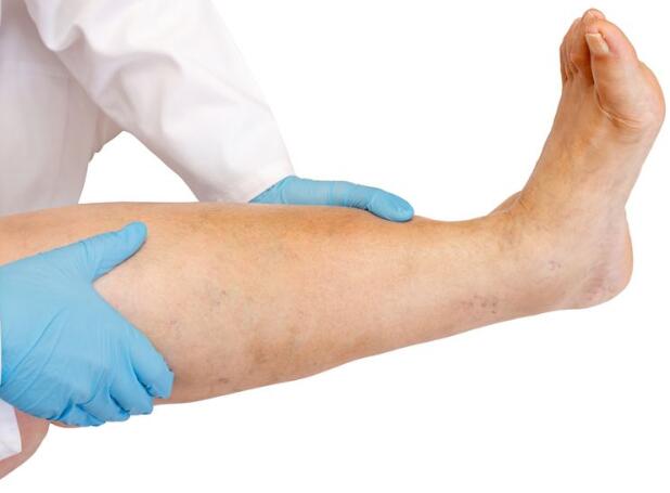 肾病|肾脏病变，四肢先知！提醒：四肢若发生4个变化，可能肾出问题了