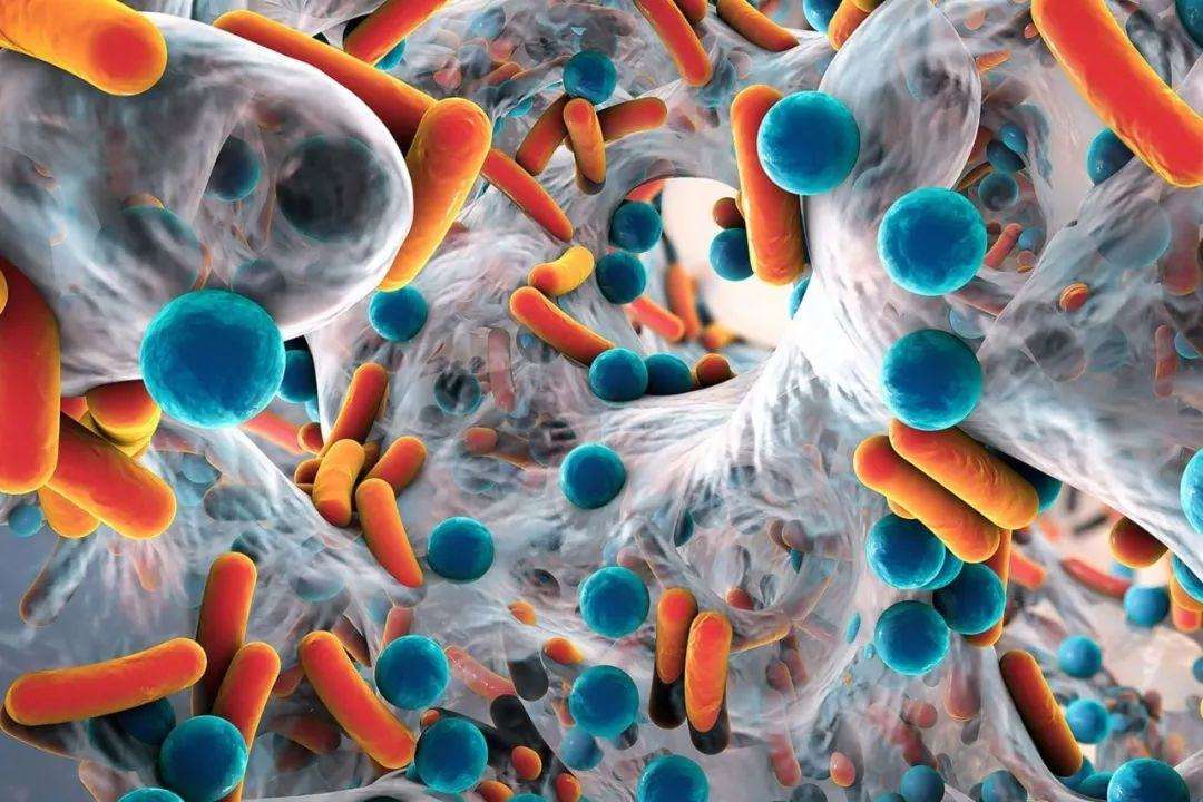 长寿|寿命“短”的人，身体3处比较“脏”，哪怕有一处干净，也是好事