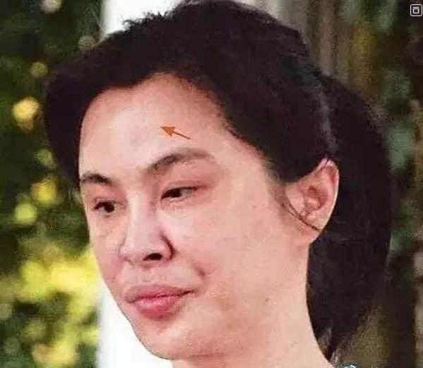 「整容」盘点被整容毁掉的女明星，萧蔷王祖贤郑裕玲，面目全非成毁容！