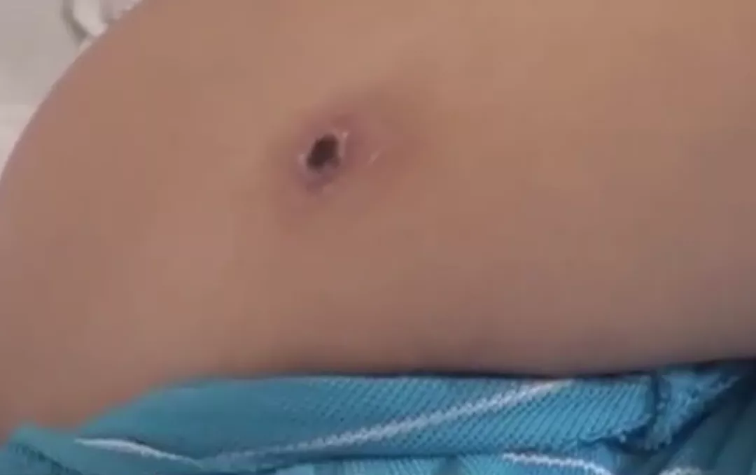 浙样的生活|女子发热一周！多次核酸检测后，罪魁祸首却是……