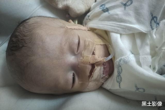 『医生』22岁女孩曾被医生判定无法生育，如今拼命产下双胞胎，却发现悲剧了